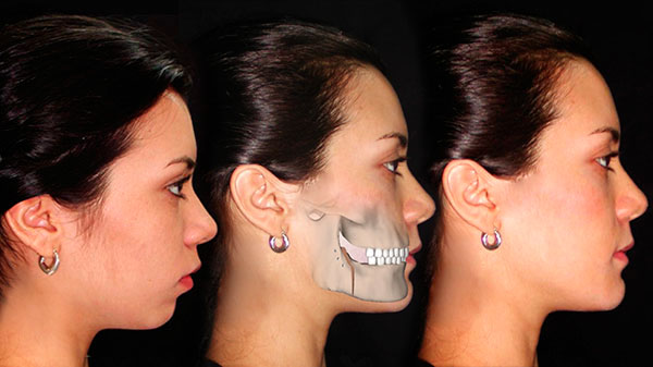 Cirugía Maxilofacial y Ortodoncia Quirúrgica Cirugía Maxilofacial y Ortodoncia Quirúrgica